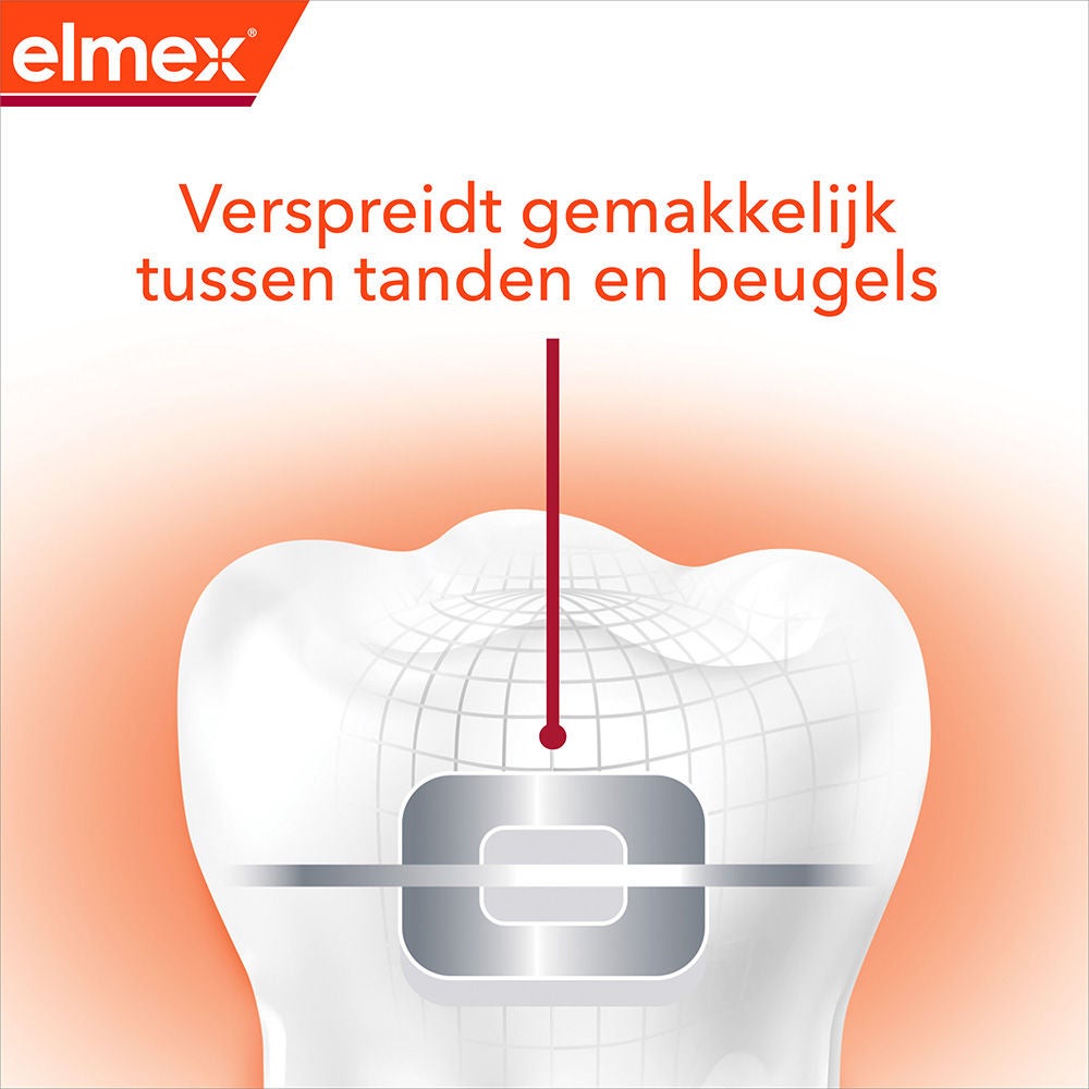 pictogram van een tand tussen haakjes met de tekst verspreidt gemakkelijk tussen tanden en beugels